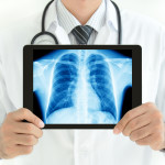 IPF chest X-Ray